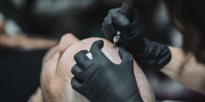 Pigmentation for men